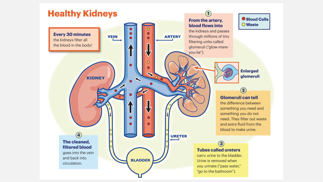 Her simplified kidney and nephron picture - "just a simplified version of what they do." Read it as the map for section 2.2: a prerenal problem sits upstream of the glomerulus, an intrarenal problem inside the tissue drawn here, a postrenal problem downstream of the collecting system.